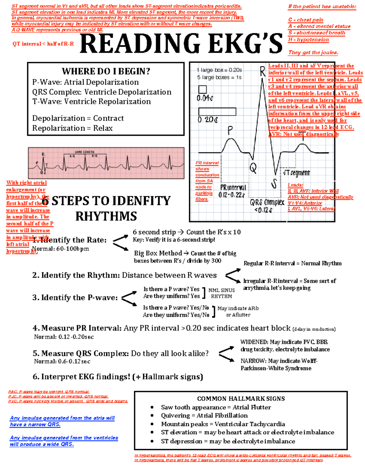 Reading EKG's - Summary Nursing Process I - NML SINUS RHYTHM Irregular ...