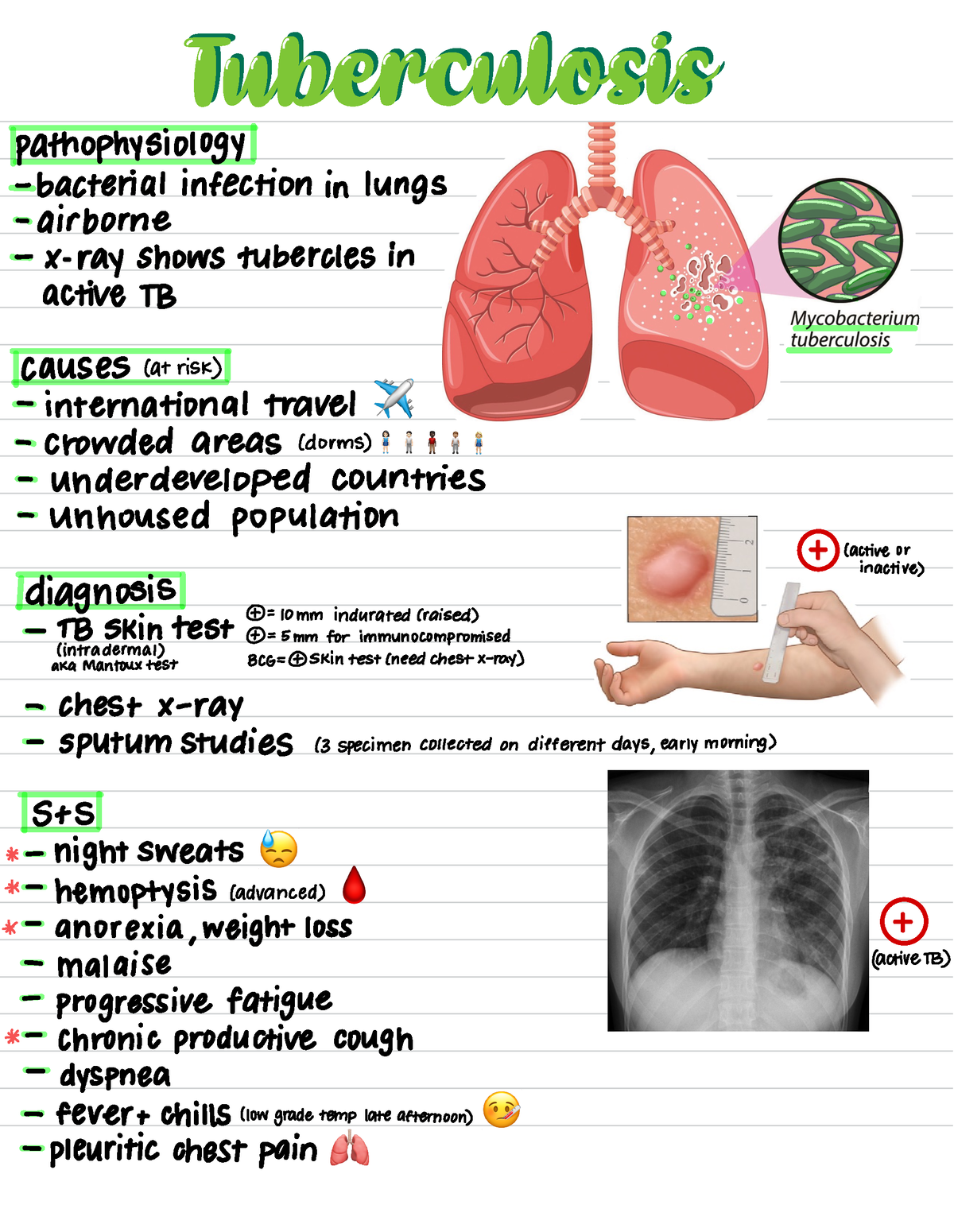 Tuberculosis - Tb notes - NUR 141 - Studocu