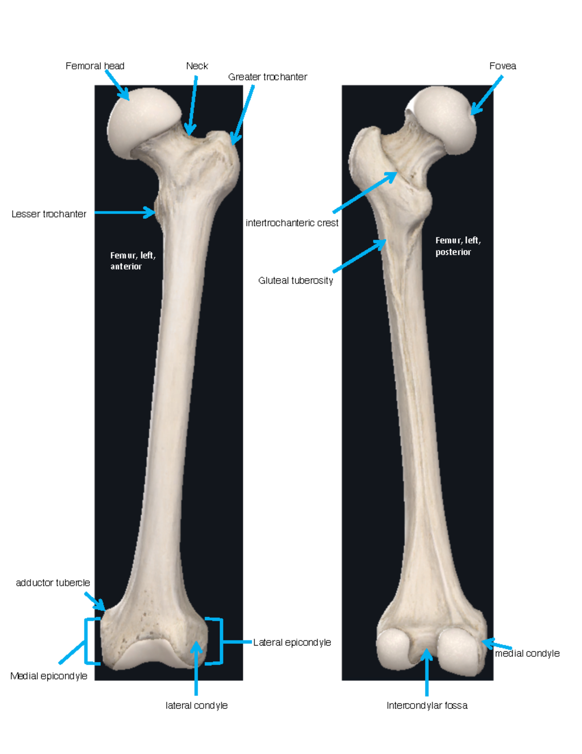 CH 6 Lower limb labs answered - ZOO 3713C - Femur, left, anterior Femur ...