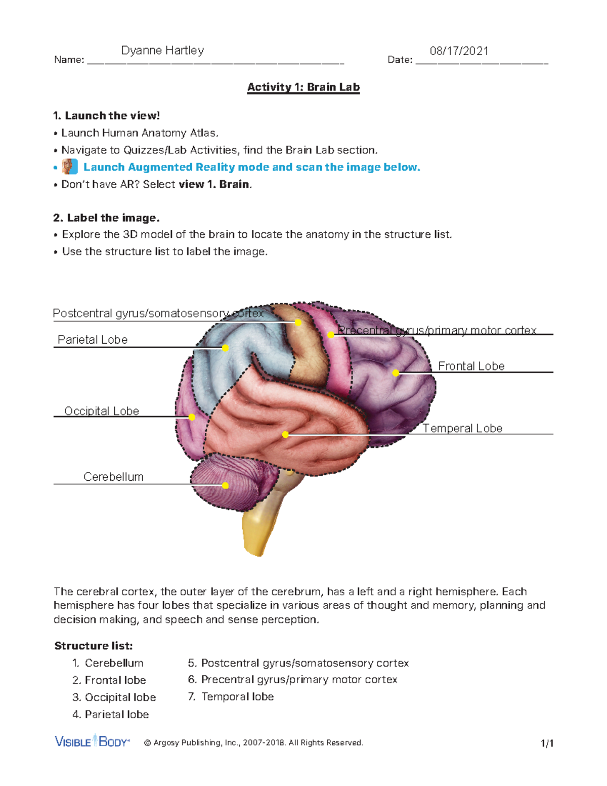 case study activity parts of the brain