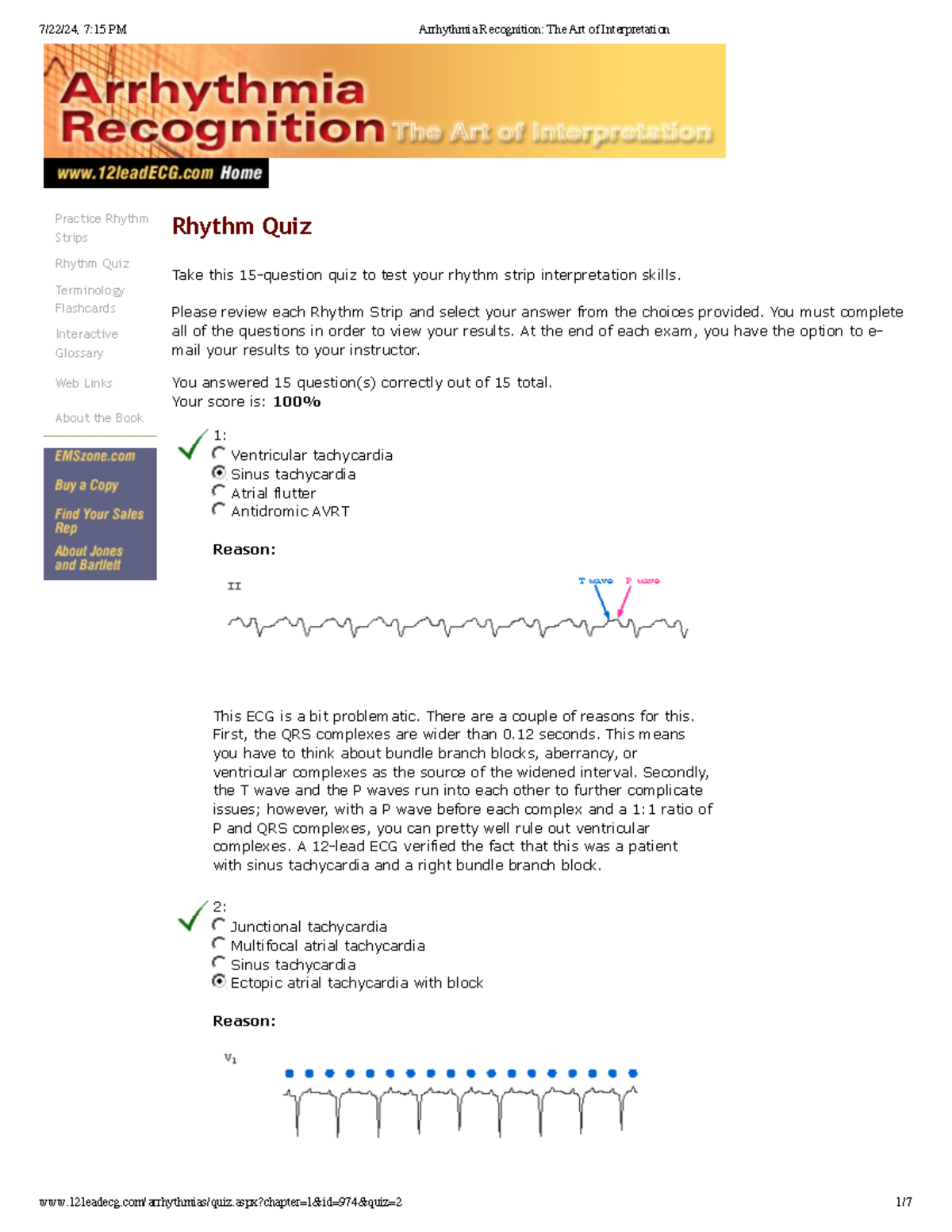 Arrhythmia Recognition The Art of Interpretation - Practice Rhythm ...