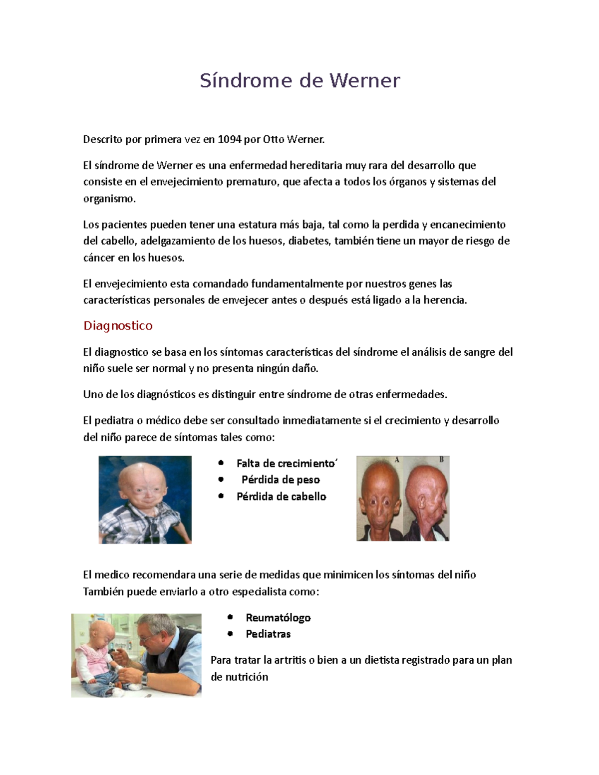 Síndrome de Werner - el sindrome de weber es muy comun al nacer por una ...