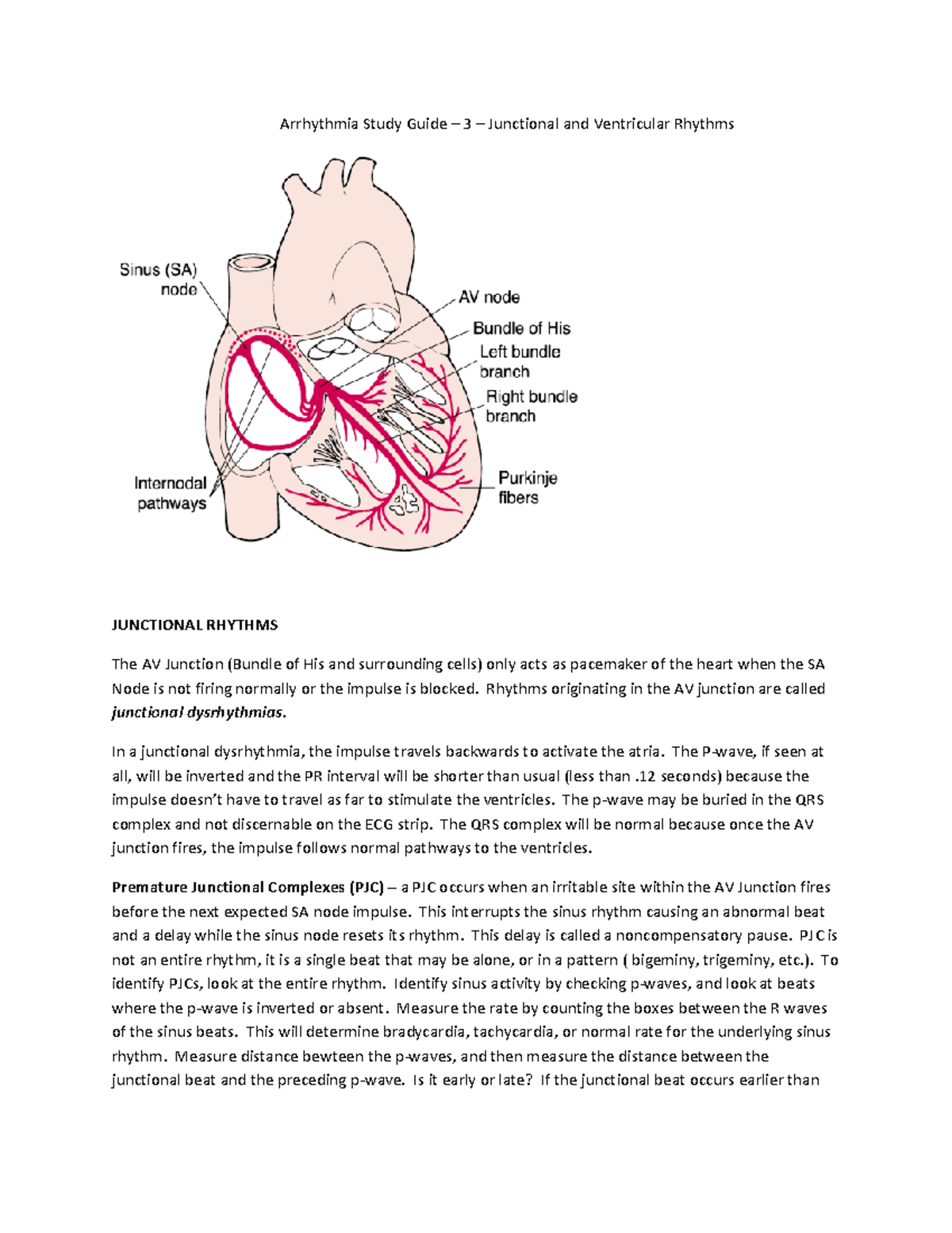 Arrhythmia Study Guide 3 Junctional and Ventricular - Arrhythmia Study ...