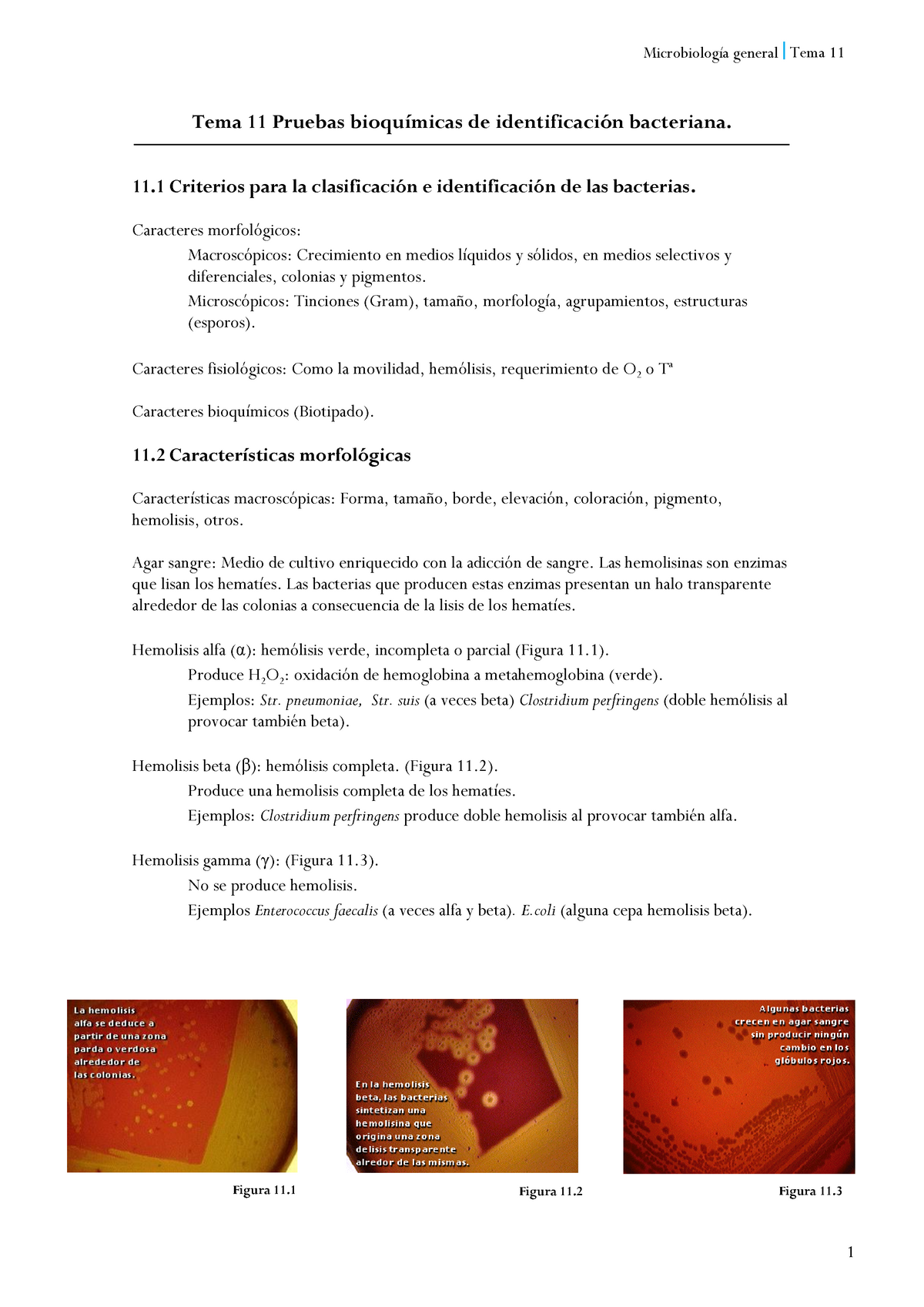 hemólisis alfa en agar sangre