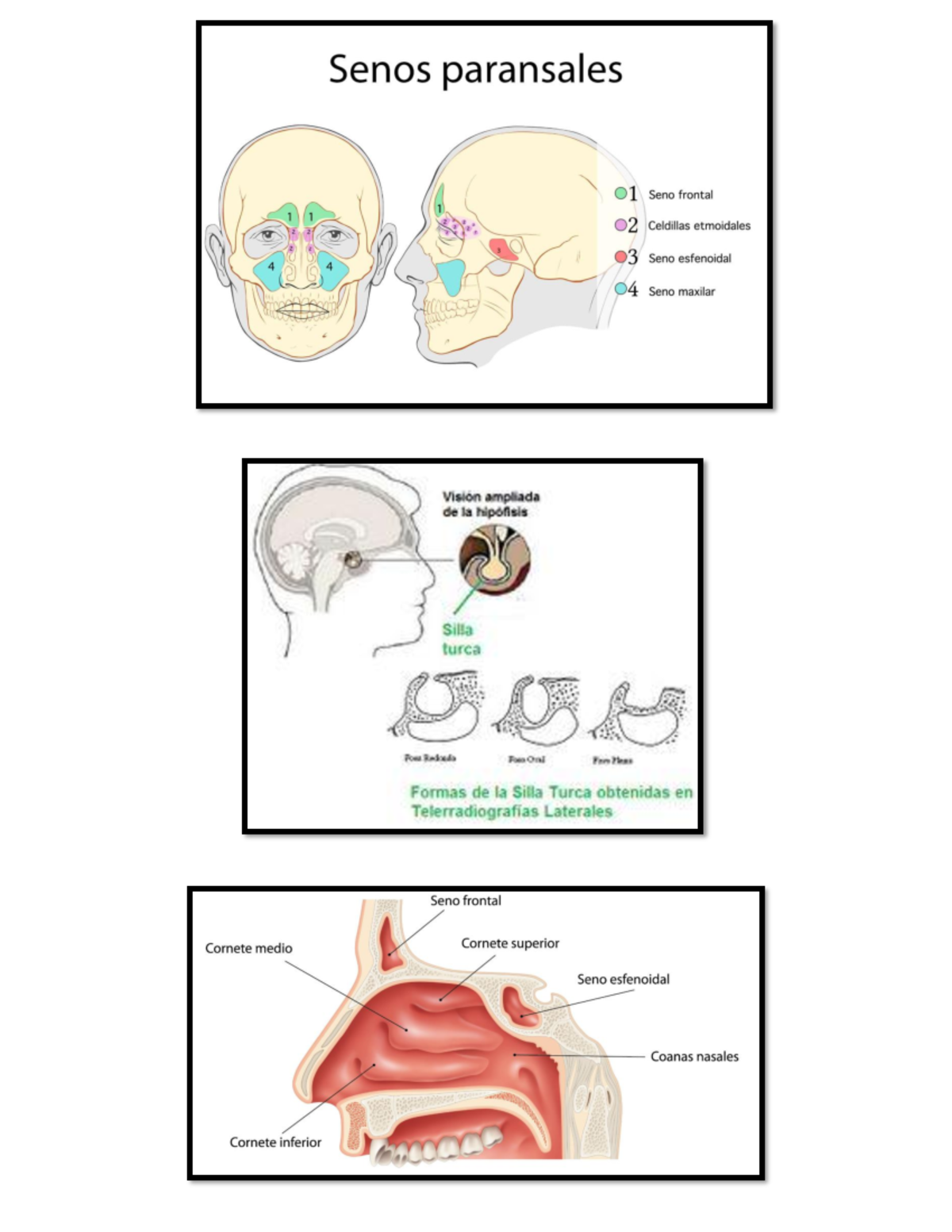 Anatomía Del Seno Etmoidal