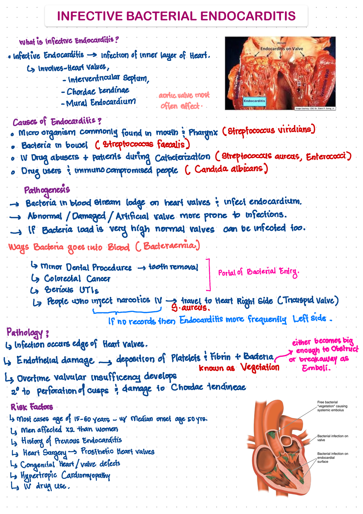 Infective endocarditis Cardiology - ####### INFECTIVE BACTERIAL ...