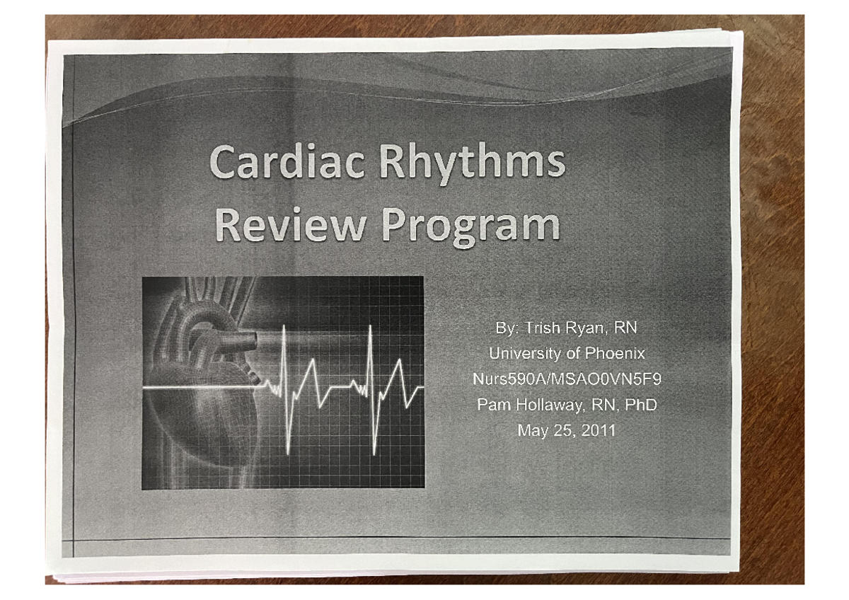 Cardiac rhythms - 20 Has P Wave, QRS, T Wave pause Way Determine ...