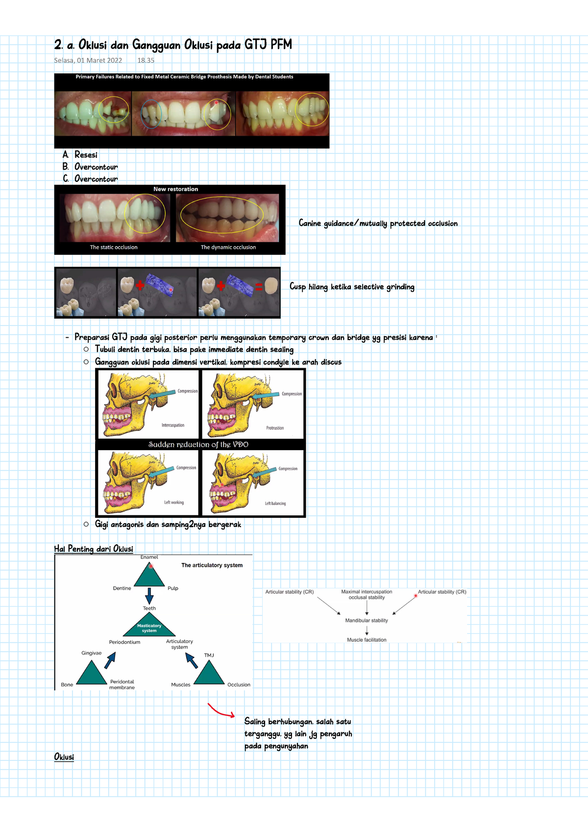Prostodonsia I - 2. A. Oklusi Dan Gangguan Oklusi Pada GTJ PFM - A ...