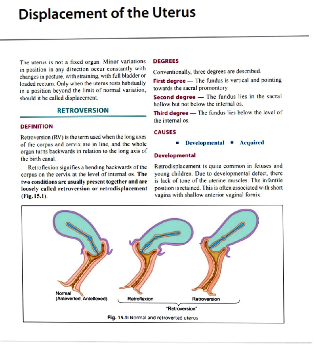 Displacement of uterus Bsc nursing Studocu
