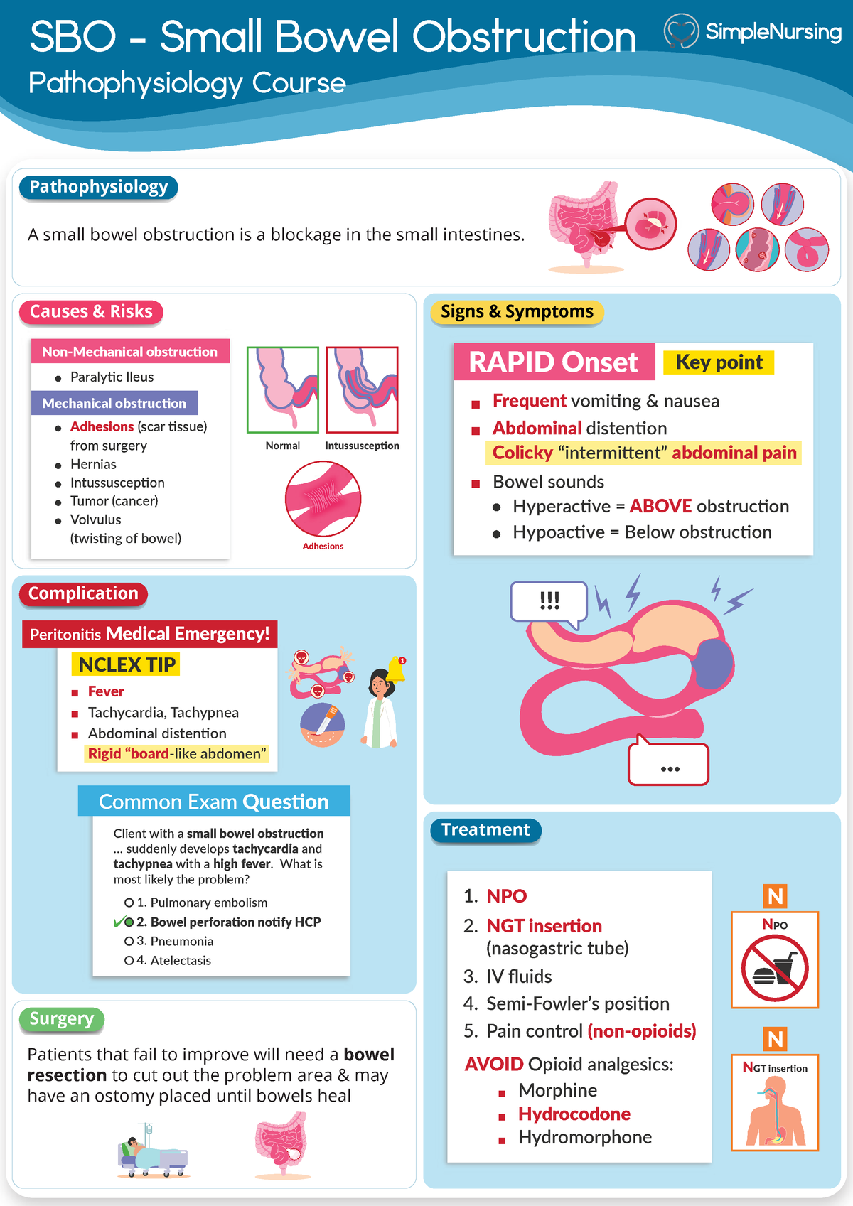 14. SBO - Small Bowel Obstruction - SBO - Small Bowel Obstruction ...