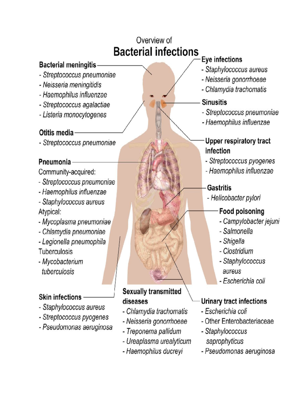 Overview of Bacterial Infections - Studocu