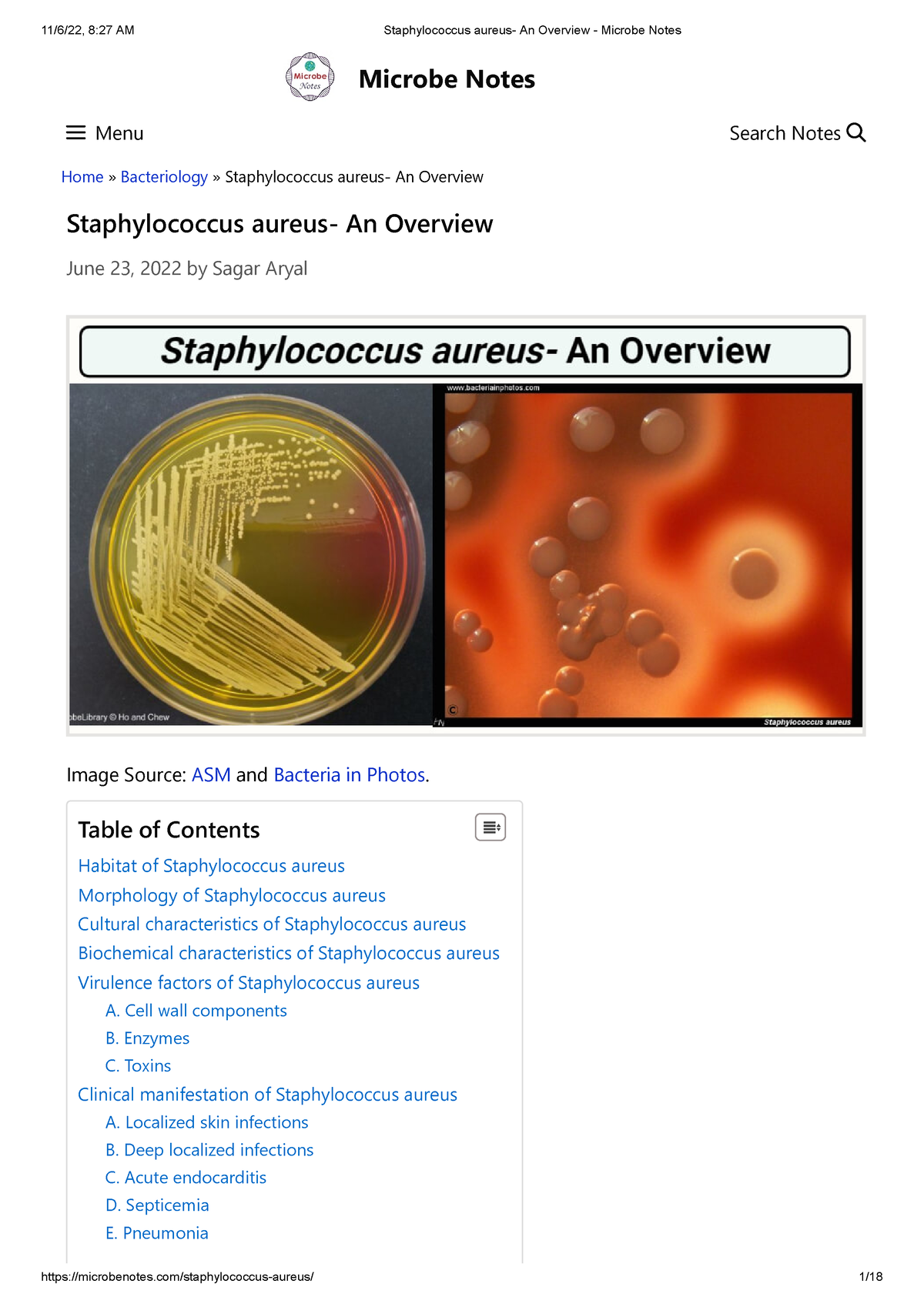 Staphylococcus aureus- An Overview - Microbe Notes