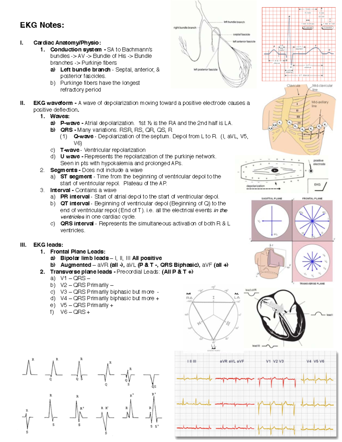 EKG Notes - EKG Notes: I. Cardiac Anatomy/Physio: 1. Conduction system ...