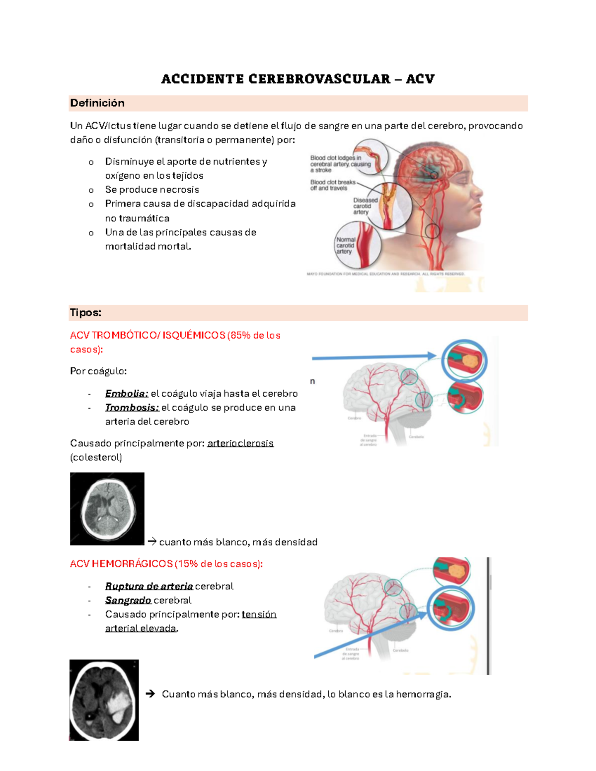 Accidente Cerebro Vascular - ACCIDENTE CEREBROVASCULAR – ACV Definición ...