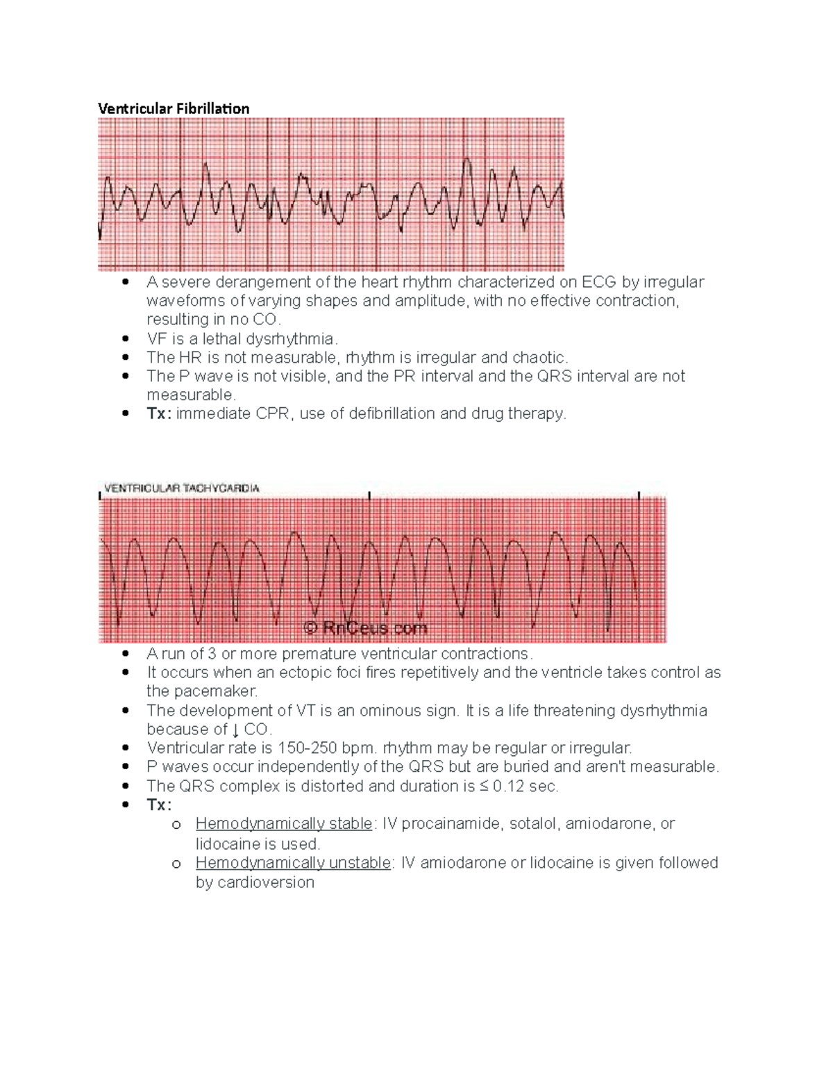 Ekg Strips Sg Summary Medical Surgical Nursing H371 Studocu