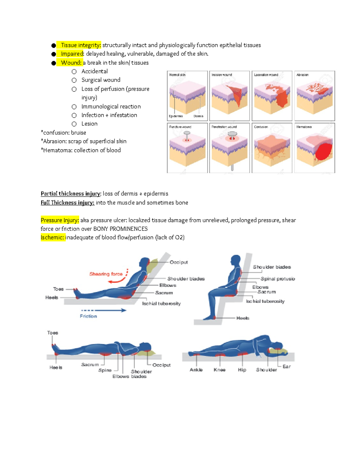 Tissue Integrity - Dr. Brown - NUR 328 - Studocu