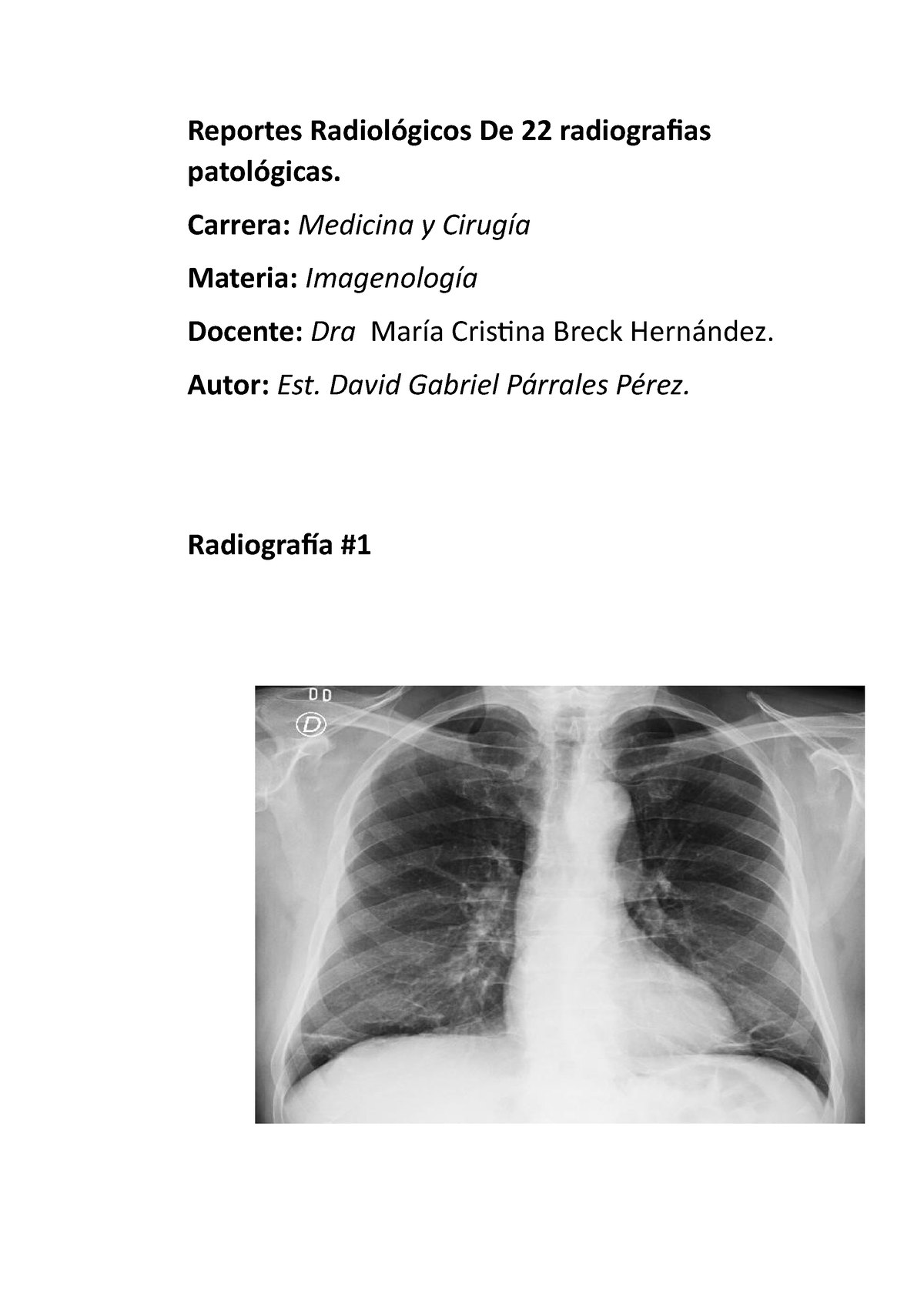 Reporte de radiografias patológicas de Imagenologia 3r año de medicina  (practicas) - Reportes - Studocu