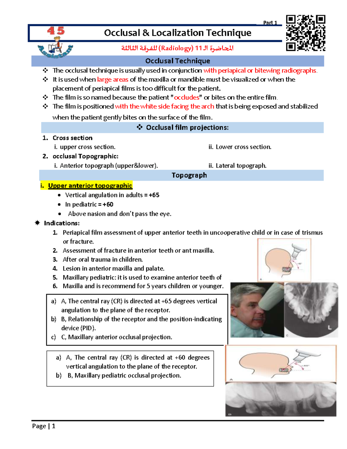 11 Occlusal localizalion technique Occlusal & Localization Technique