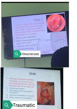Ear, OSCE questions with pictures - Slide 1 A female with gradually ...