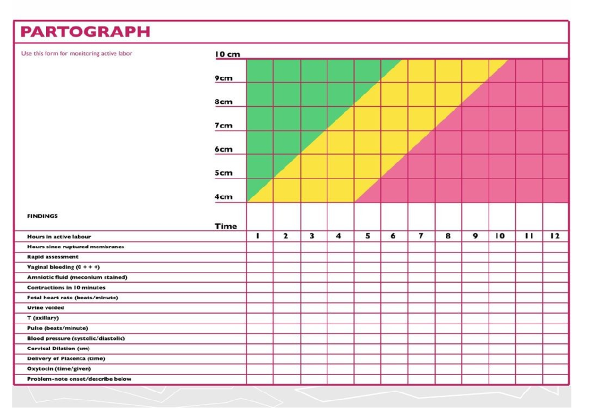 Partograph - PARTOGRAPH Use this form for monitoring active labor 10 cm ...