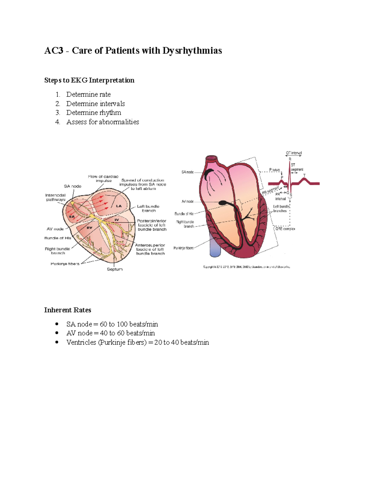 AC3 - Dysrhythmias - notes - AC3 - Care of Patients with Dysrhythmias ...