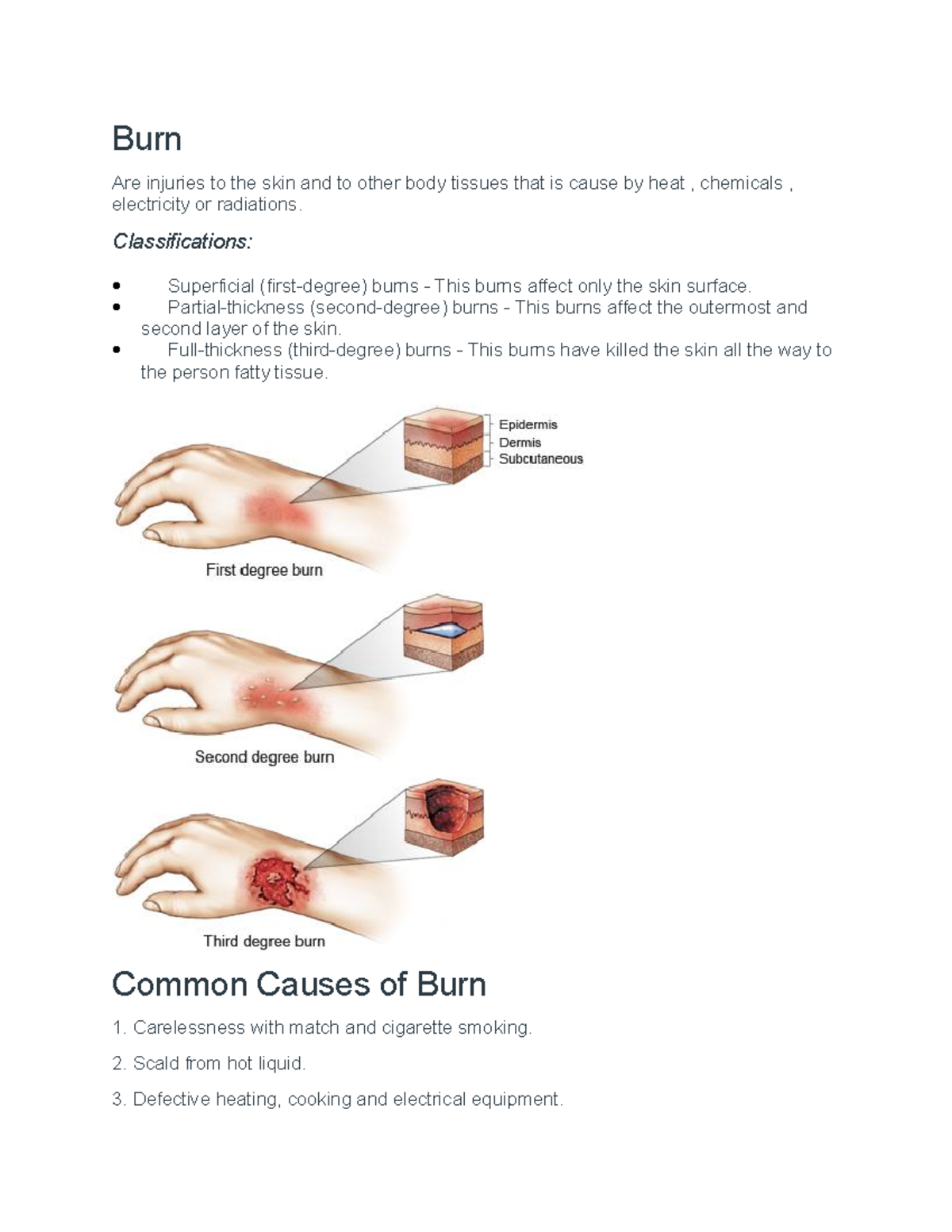 Burn - Burns Are Injuries To The Skin And To Other Body Tissues That Is 