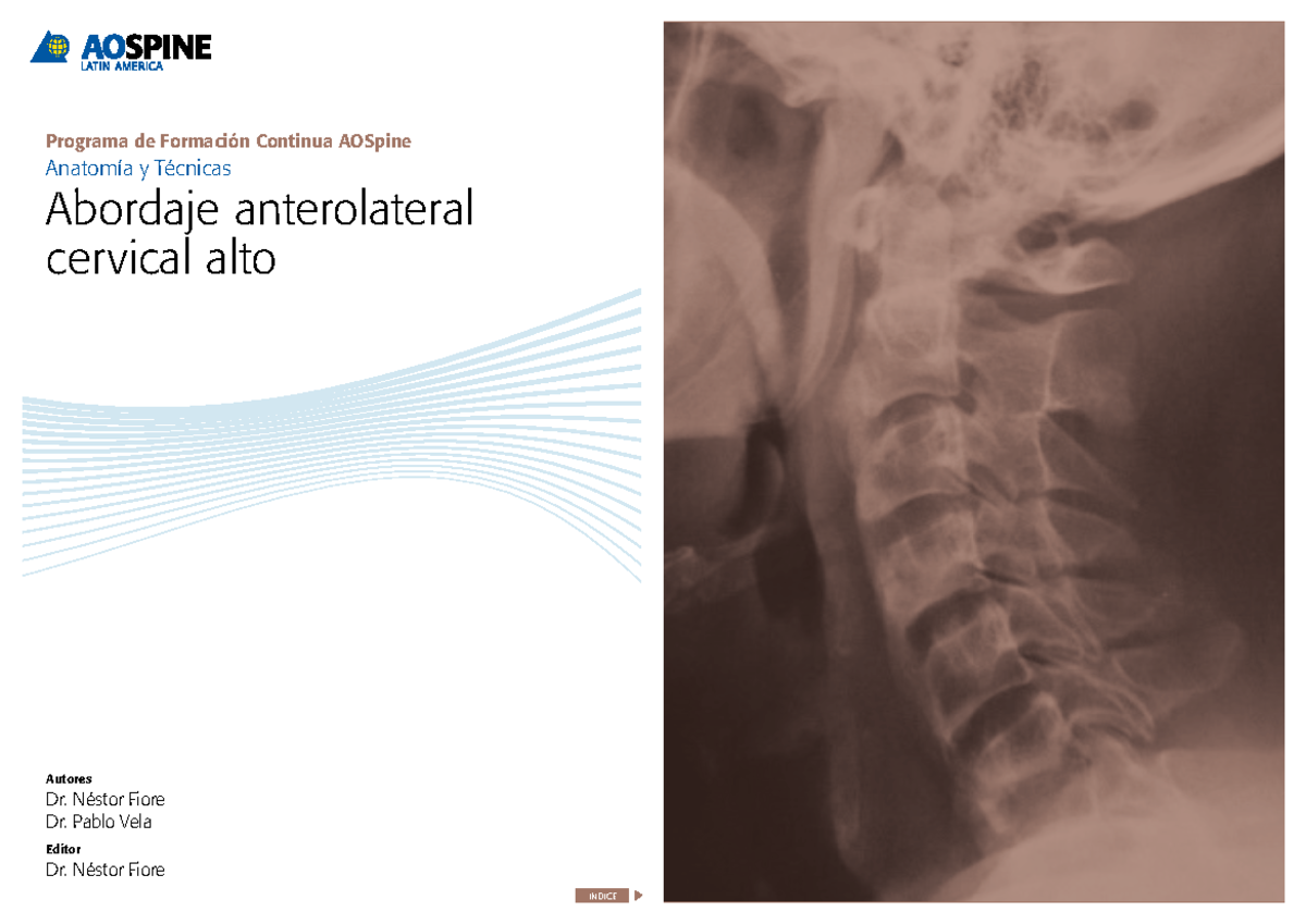 Aos Da C3m1t2 Fiorevela Esp - Programa De Formación Continua AOSpine ...