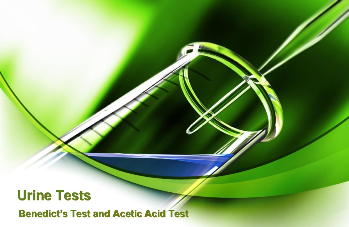 Urine Test 2020 Urine Tests Benedict’s Test and Acetic Acid Test