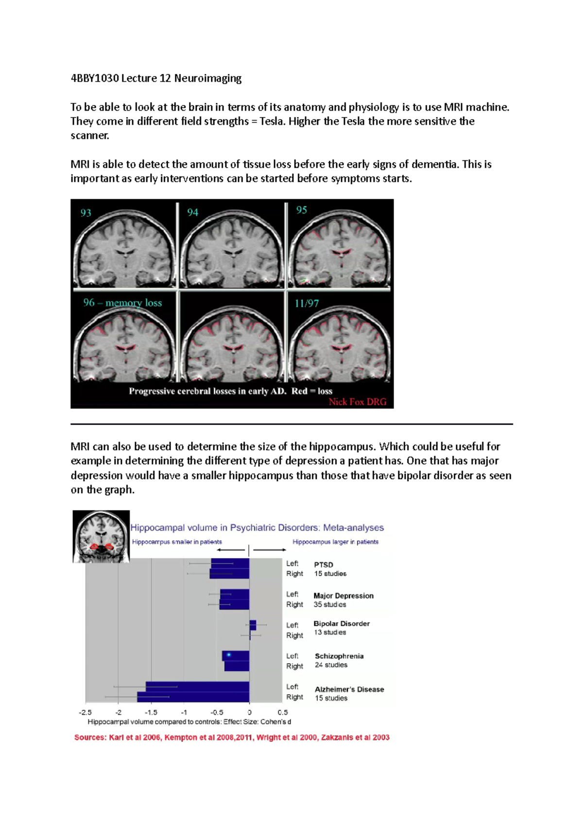 4BBY1030 Lecture 12 Neuroimaging - 4BBY1030 Lecture 12 Neuroimaging To ...