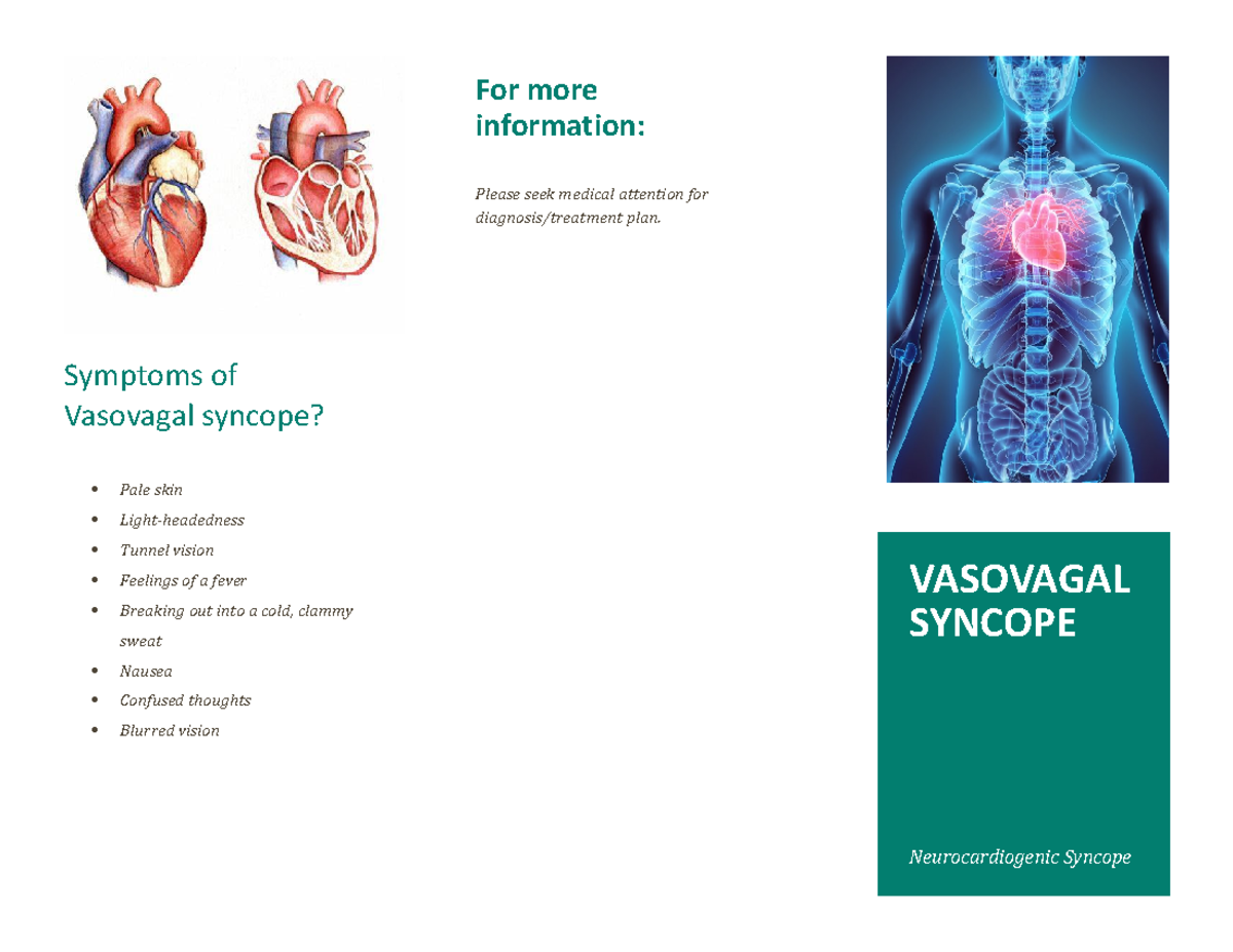 Symptoms Of Vasovagal Syncope - Symptoms Of Vasovagal Syncope? Pale ...