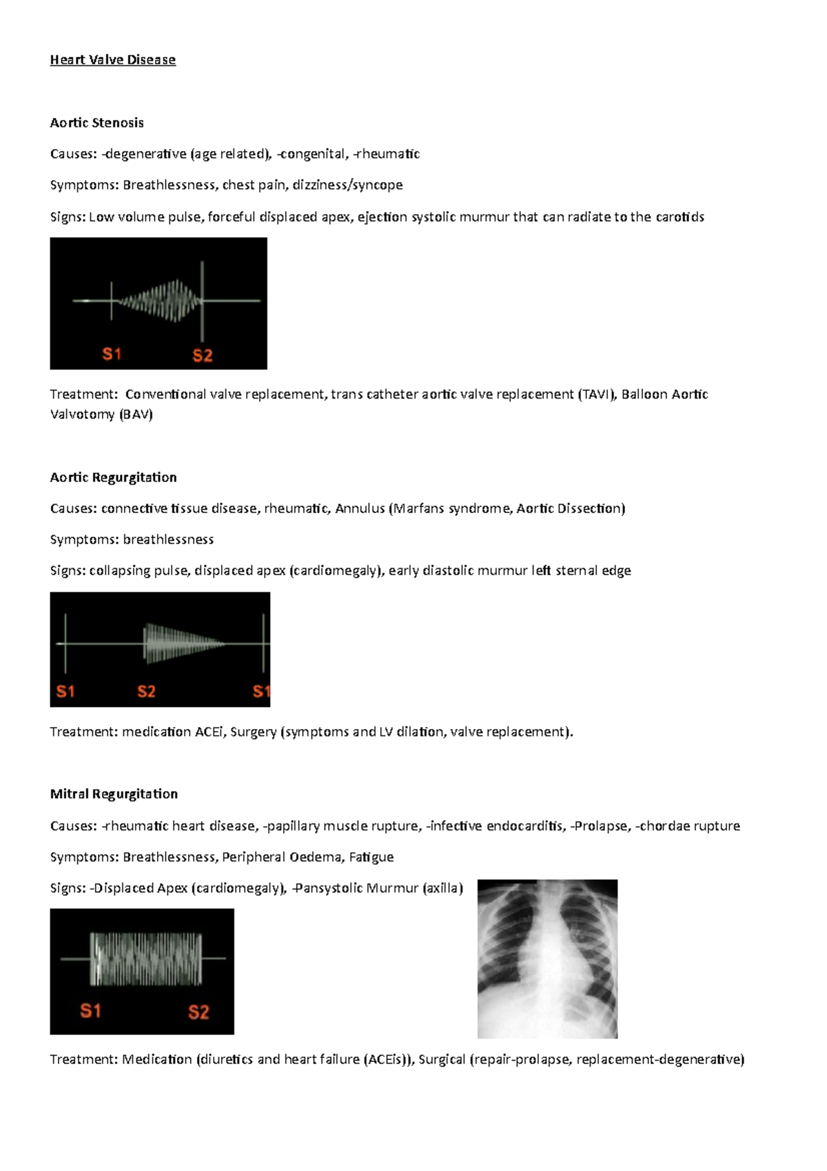 heart-valve-disease-heart-valve-disease-aoric-stenosis-causes