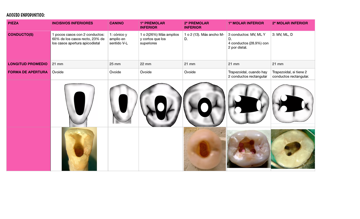 Acceso Endodontico pdf-3 - ACCESO ENDODÓNTICO: PIEZA INCISIVOS
