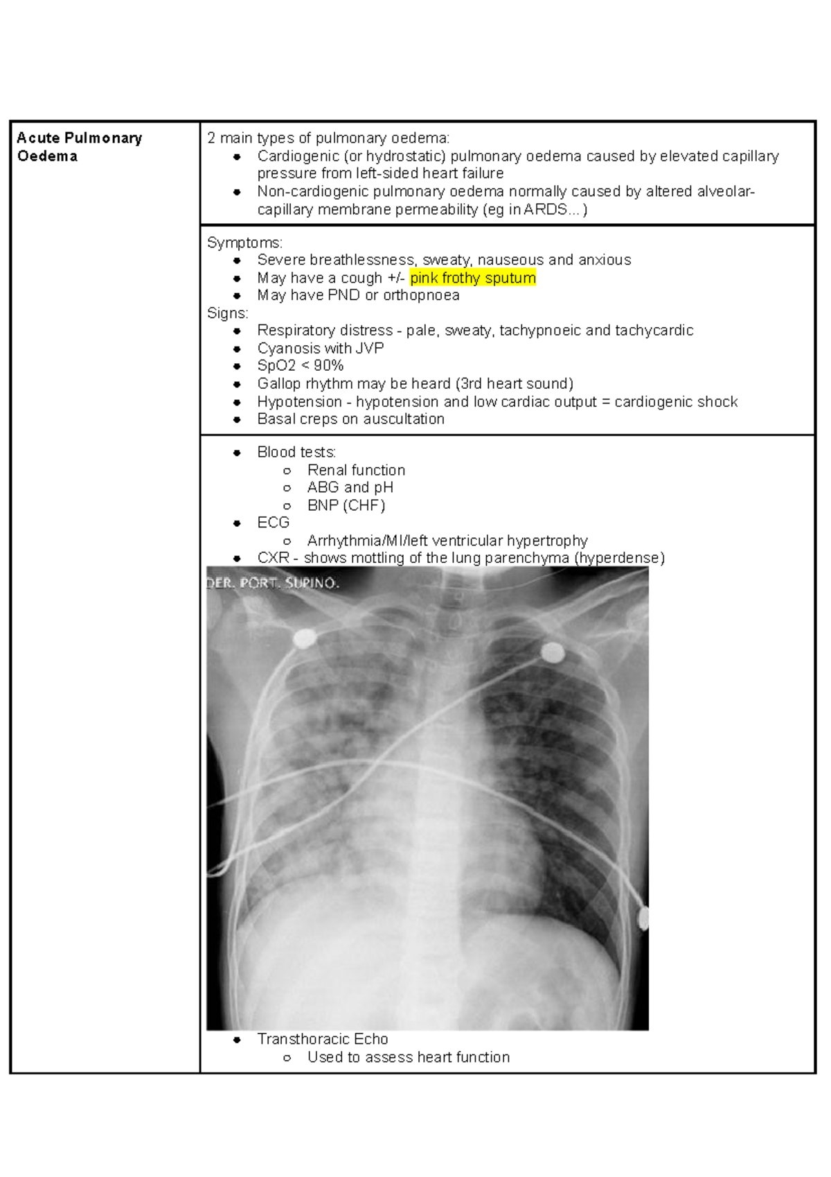 Key Conditions - Breathlessness - Acute Pulmonary Oedema 2 main types ...