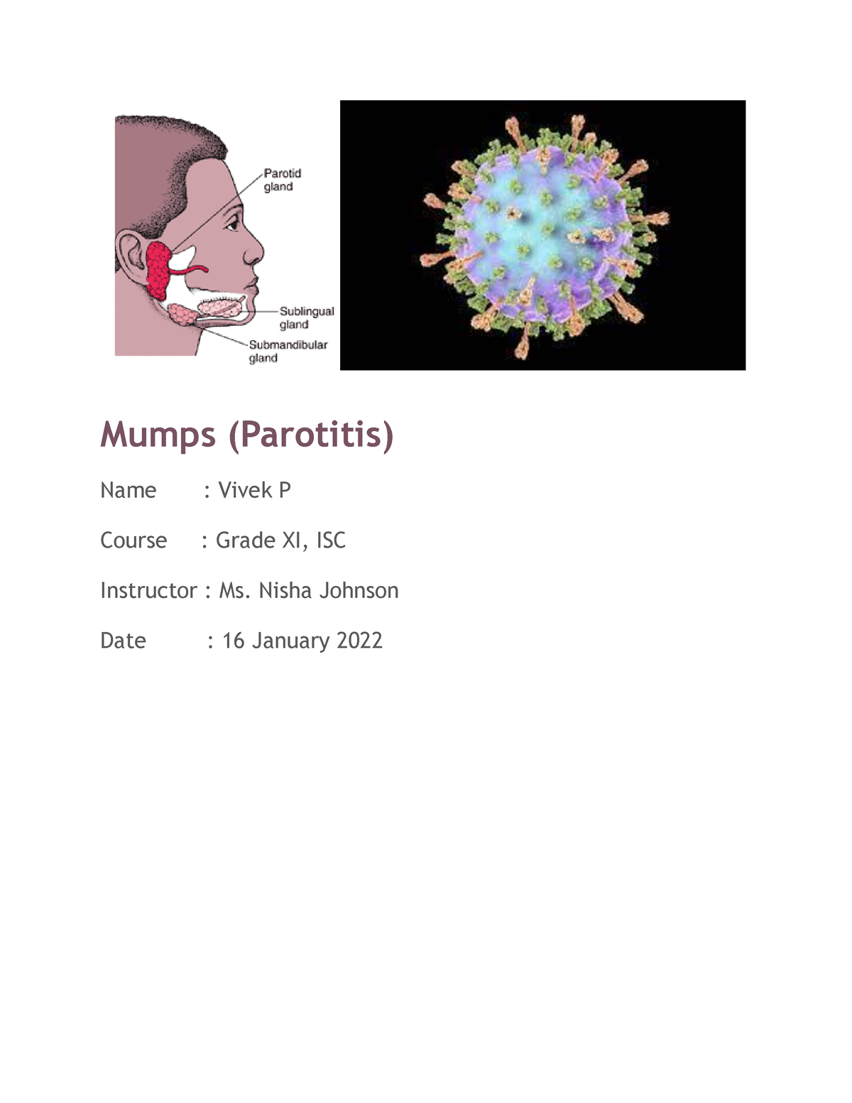 mumps introduction for assignment