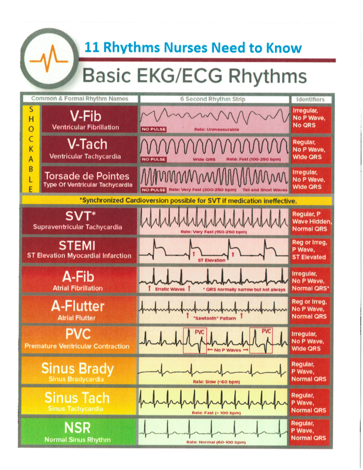 Cardiac Rhythms - nur 160 - Studocu