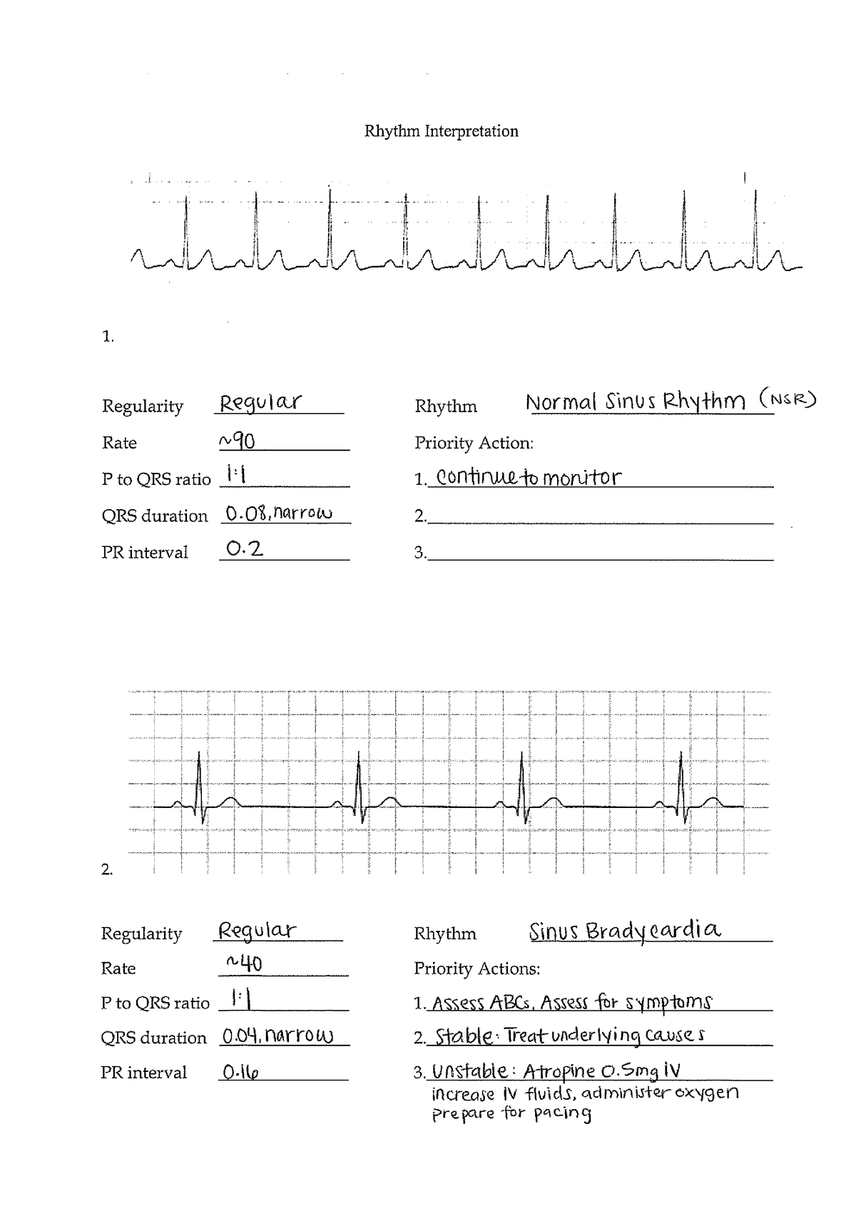 Practice - Rhythm Interpretation Answers - NURS 313R - Studocu