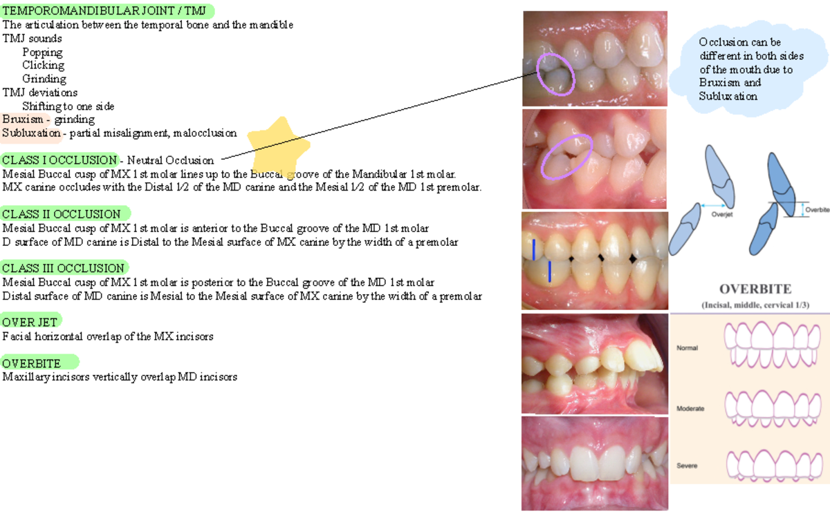 Occlusion And TMJ Mrs. Cherney. Fall 2022 TEMPOROMANDIBULAR JOINT