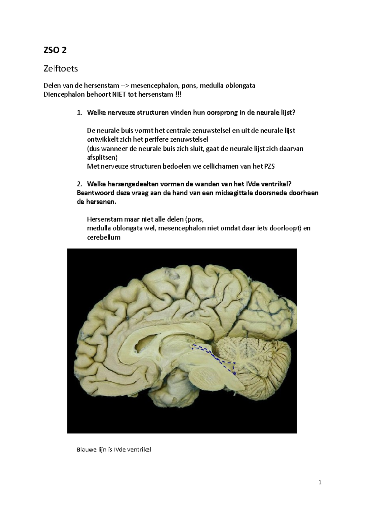 ZSO 2 Biomedische Neurowetenschappen - ZSO 2 Zelftoets Delen Van De ...