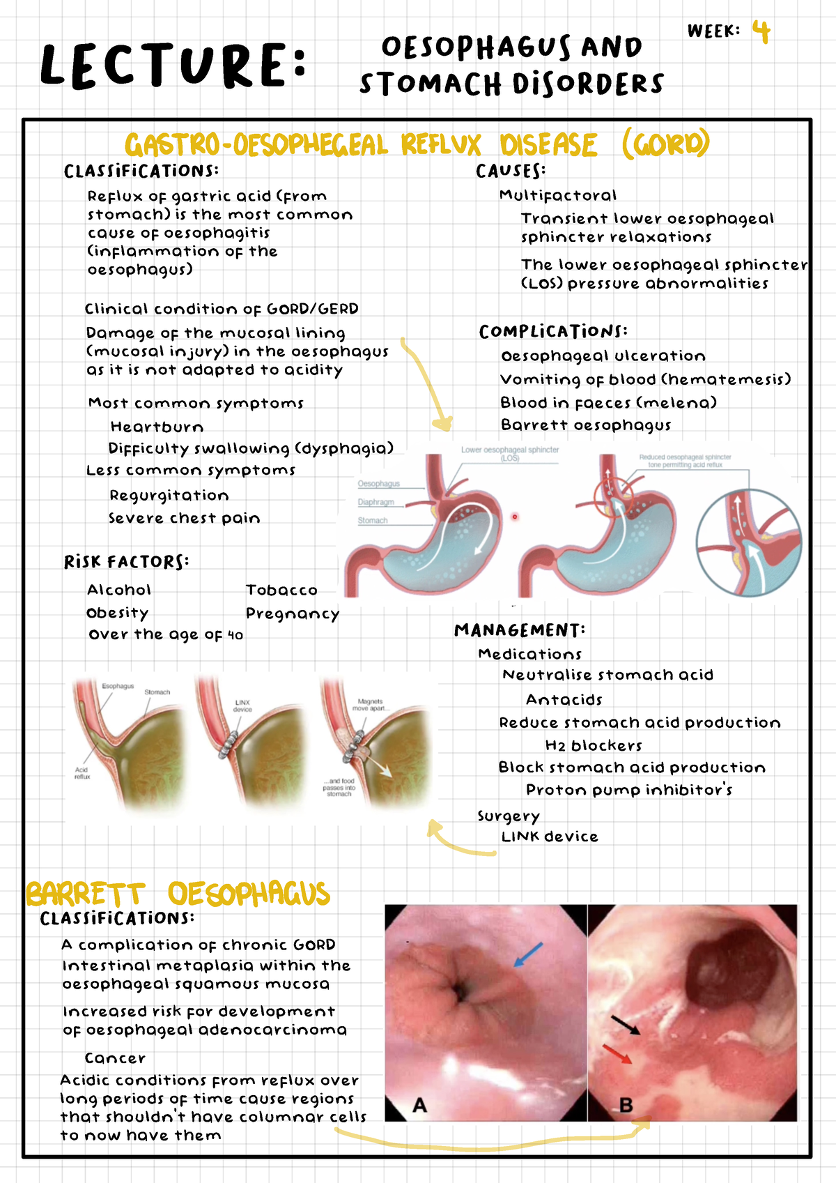 Digestive system disorders notes - L!