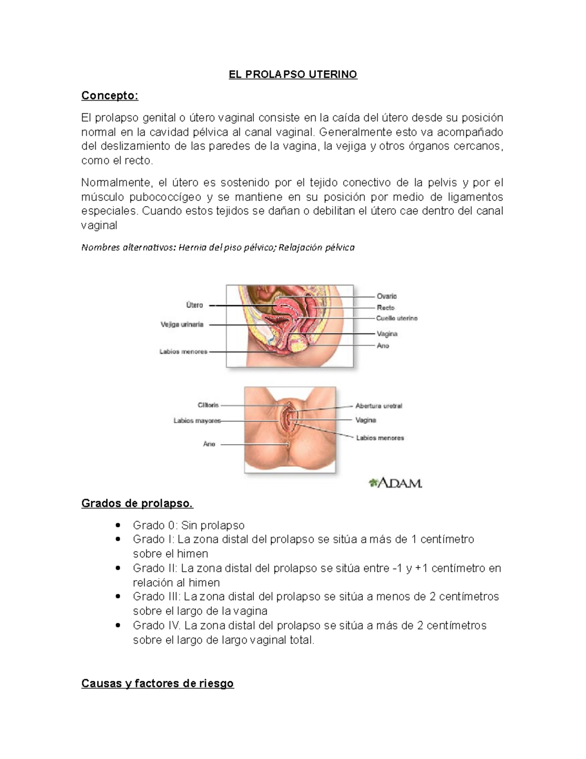 EL Prolapso Uterino - cuidados en el adulto mayor - EL PROLAPSO UTERINO ...