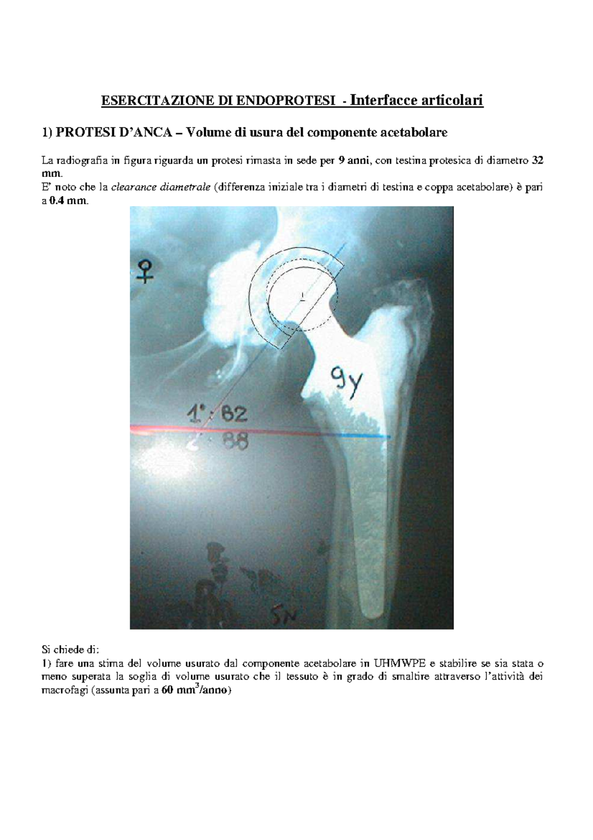INSERTO DI USURA AUTOCENTRANTE | Altri