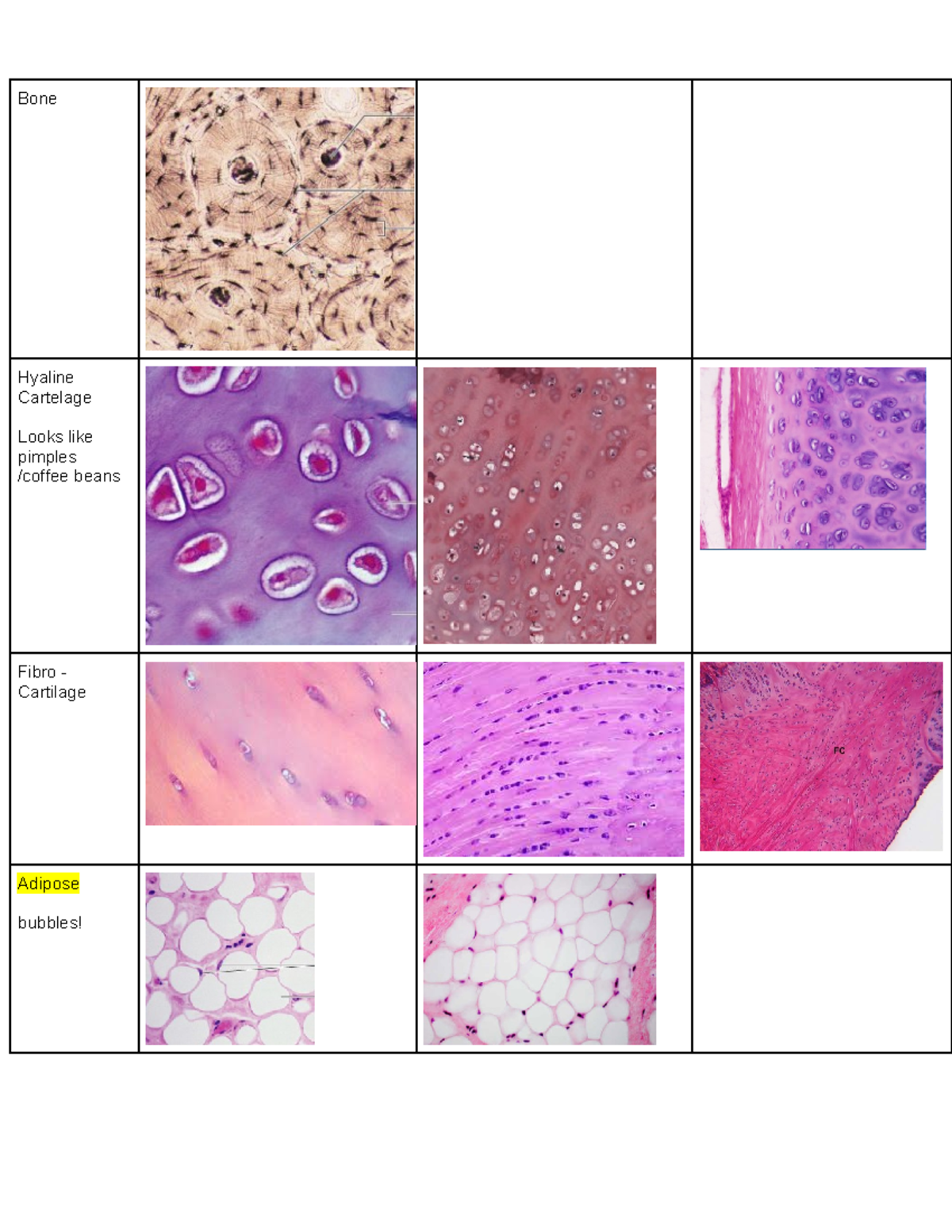 Muslces and Tissues - Summary Human Pathophysiology - Bone Hyaline ...