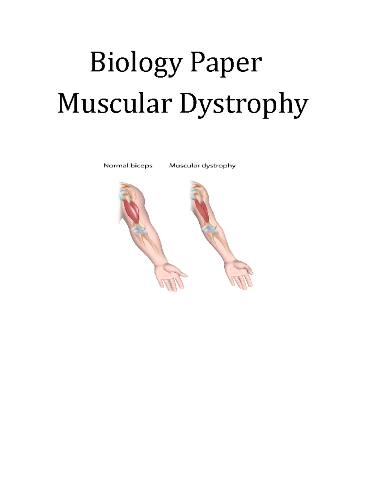 research paper on muscular dystrophy