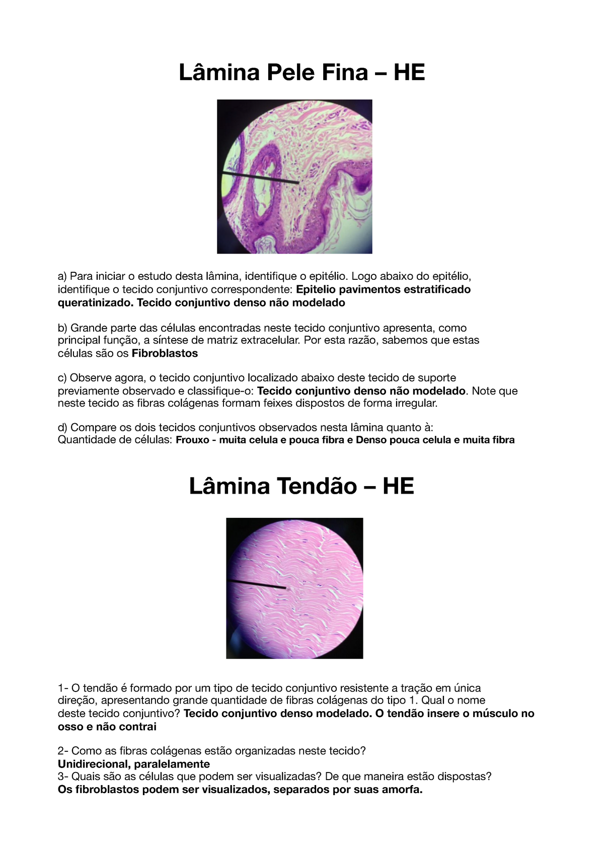 Tecido Conjuntivo Histologia Estacio Mina Pele Fina He Para Iniciar Estudo Studocu