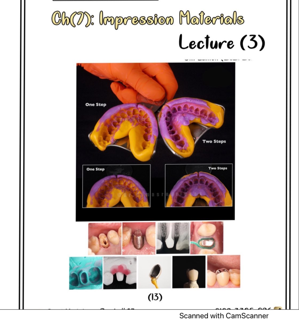 Impression Materials Dental Materials I Studocu