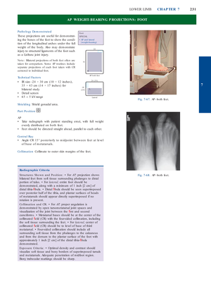 AP OBLIQUE PROJECTION—LATERAL (EXTERNAL) ROTATION: KNEE - No te : A ...