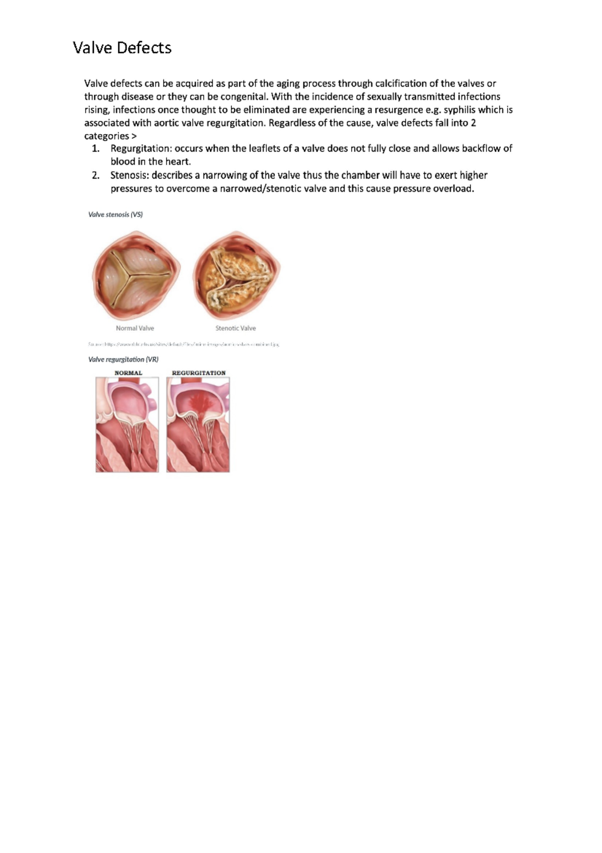 Valve Defects 2808NRS Griffith Studocu