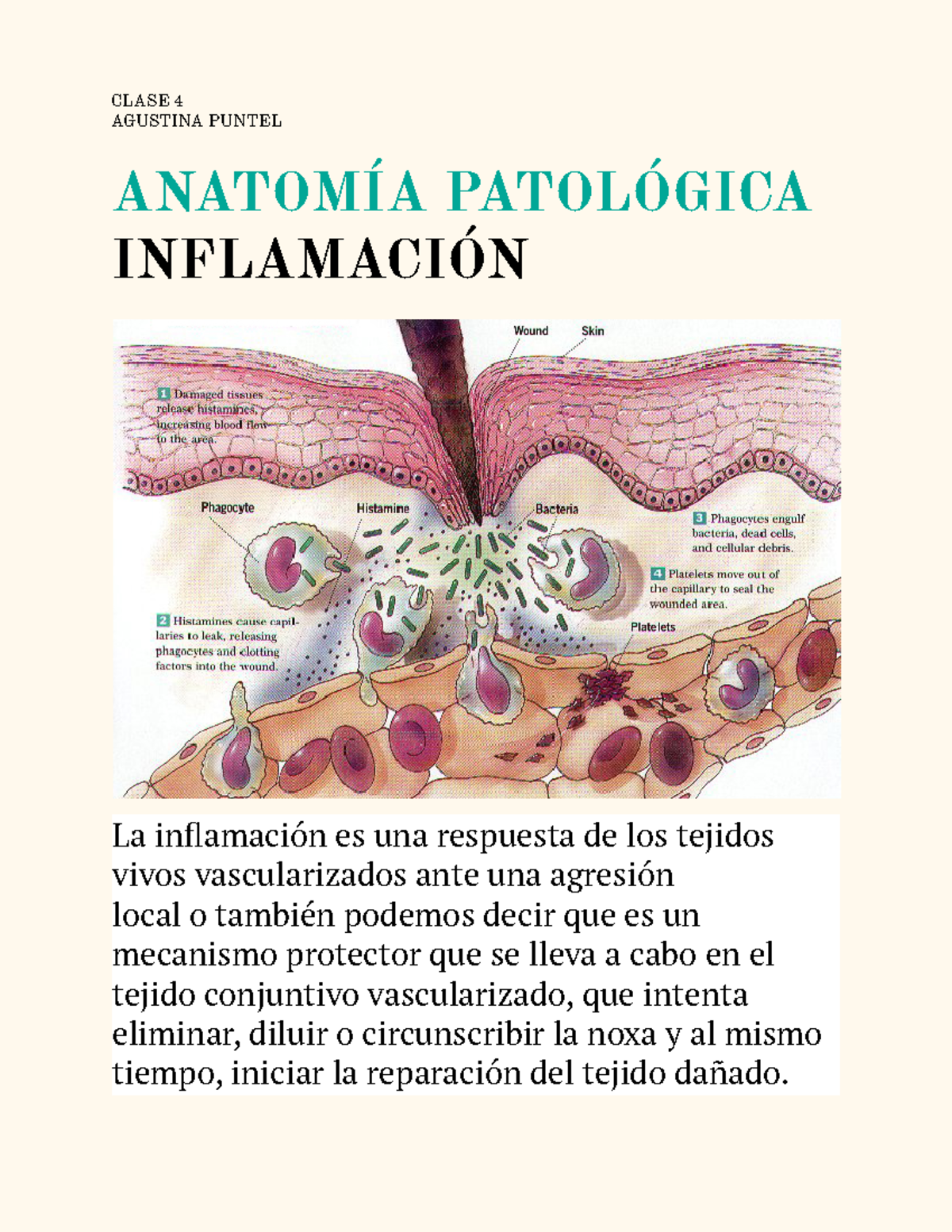 Clase inflamacion teoria CLASE 4 AGUSTINA PUNTEL ANATOMÍA PATOLÓGICA