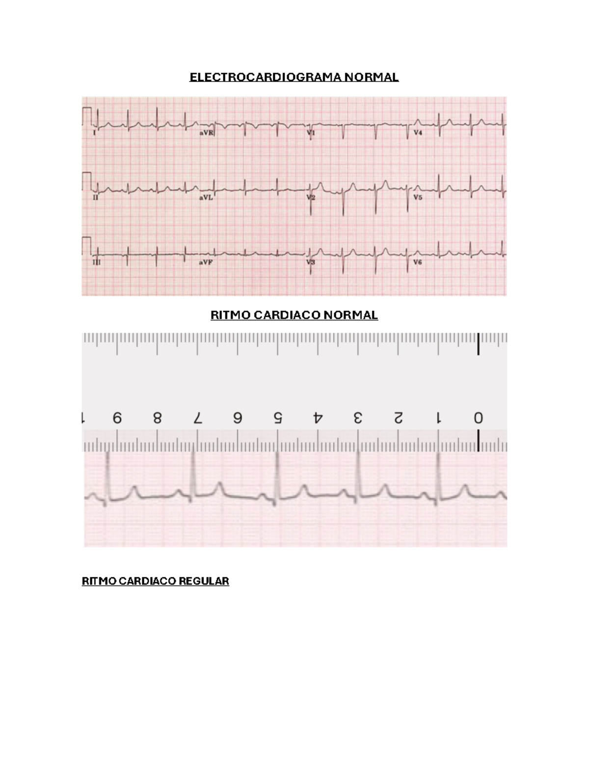 Electrocardiograma Normal - Fisiología Humana - ELECTROCARDIOGRAMA ...