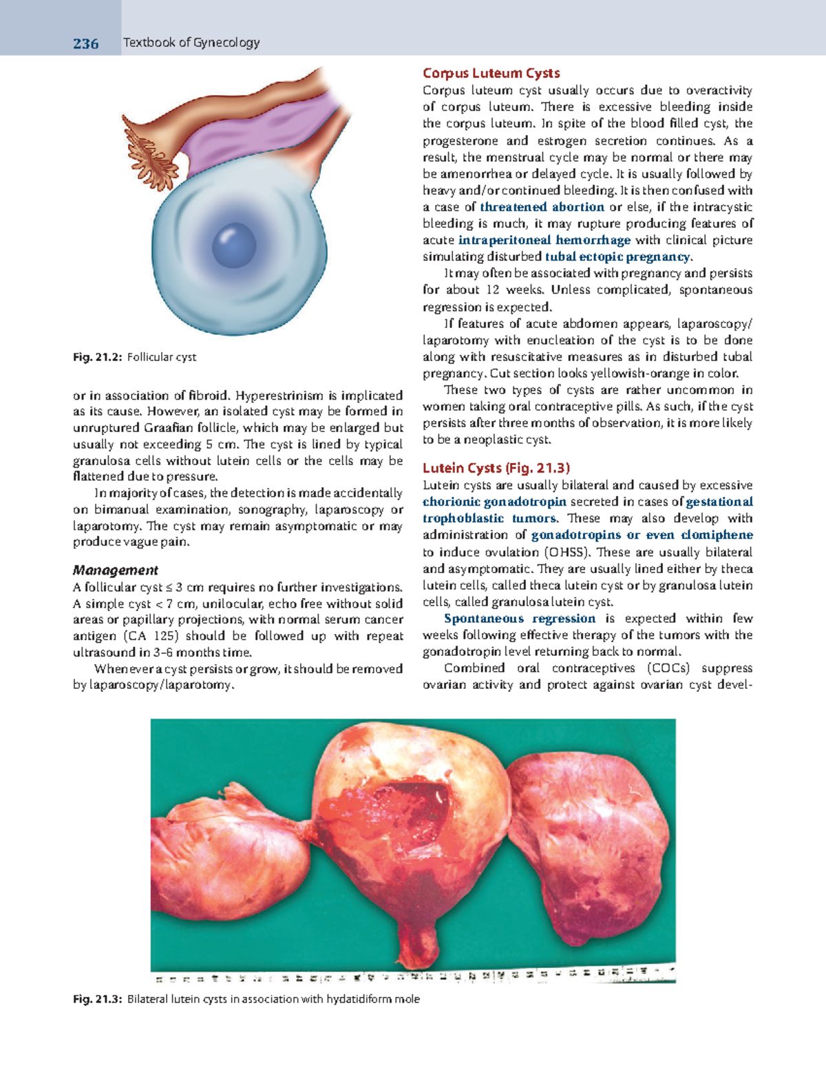 4. Dutta'ss Textbook of Gynecology - 7th-18Lecture Notes - 236 Textbook ...